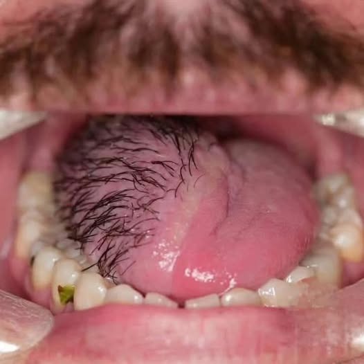 These are the consequences of eating