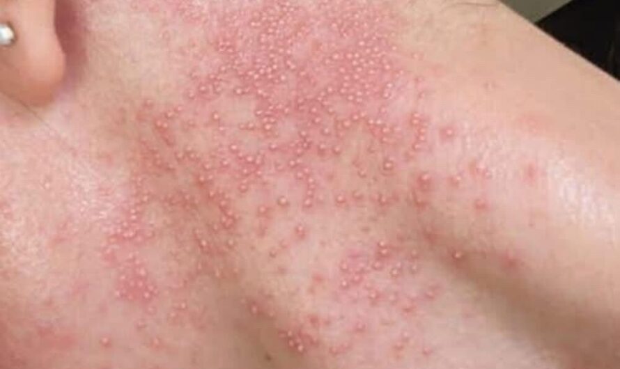 These are the consequences of eating…