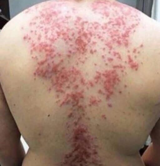 These are the consequences of sleeping with the…See more