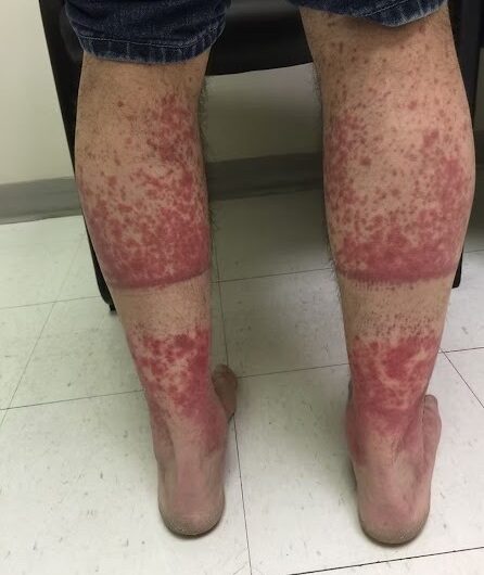 These are the consequences of sleeping with…See more