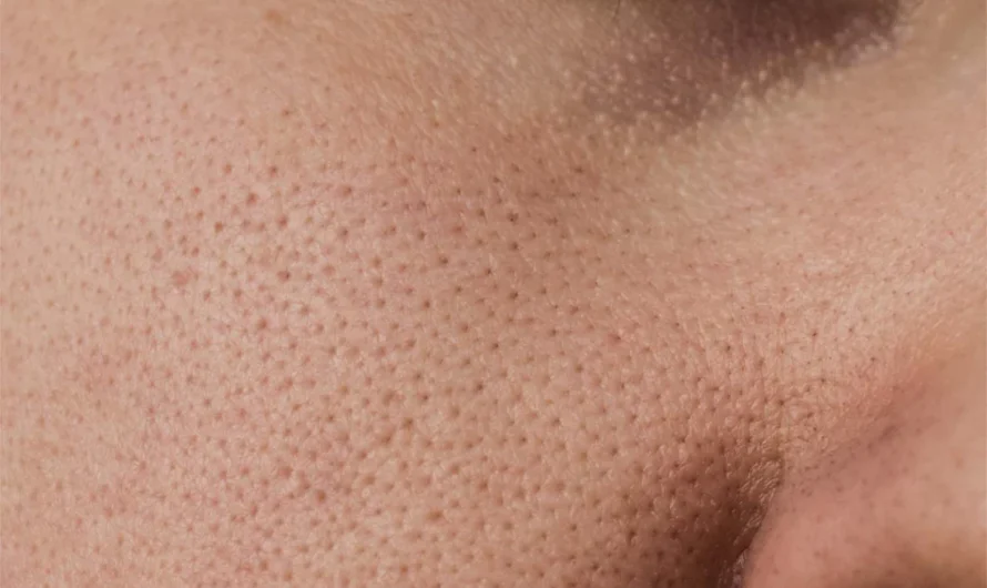 The Real Consequences of Sleeping With…