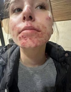 These are the consequences of sleeping with a… See more here