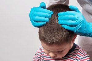 What to Do When Scalp Bumps Appear on Your Child: A Guide for Concerned Parents